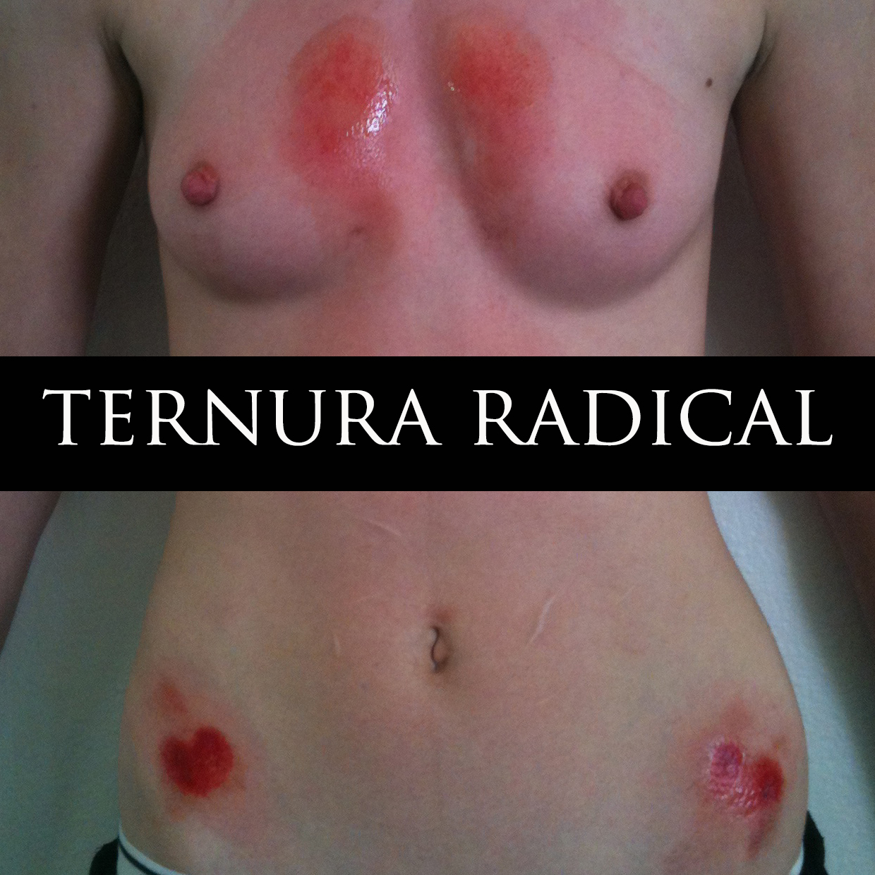 Bleeding_Chest_ternuraradical